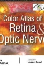 Color Atlas of Retina & Optic Nerve af Mohan Rajan
