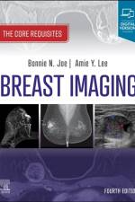 Breast Imaging af Bonnie N. (Professor Joe