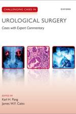 Challenging Cases in Urological Surgery af Karl H. Pang