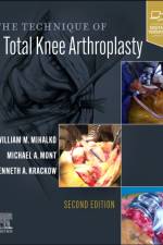 The Technique of Total Knee Arthroplasty