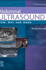 Abdominal Ultrasound