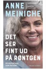 Det ser fint ud på røntgen af Anne Meiniche