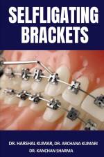 Selfligating Brackets af Harshal
