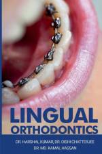 Lingual Orthodontics af Kumar Harshal