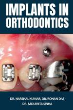 Implants in Orthodontics af Harshal