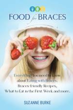 Food for Braces af Suzanne Burke