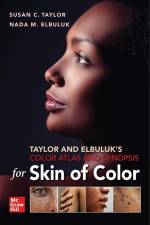 Taylor and Elbuluk's Color Atlas and Synopsis for Skin of Color af Susan Taylor