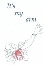 It's my arm af Tony Weston