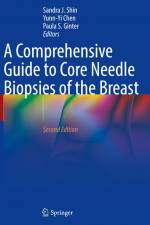 Comprehensive Guide to Core Needle Biopsies of the Breast af Sandra J. Shin