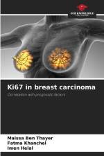 Ki67 in breast carcinoma af Maissa Ben Thayer