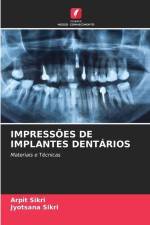 IMPRESSÕES DE IMPLANTES DENTÁRIOS af Arpit Sikri