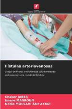 Fístulas arteriovenosas af Chaker Jaber