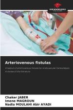 Arteriovenous fistulas af Chaker Jaber