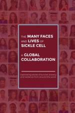 The Many Faces and Lives of Sickle Cell - A Global Collaboration af Agnes Nsofwa