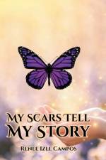 My Scars Tell My Story af Renee Izle Campos