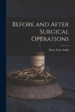 Before and After Surgical Operations af Dean Tyler Smith