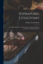 Suprapubic Lithotomy: The High Operation For Stone, Epicystotomy, Hypogastric Lithotomy (the High Apparatus) af William Tod Helmuth