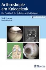 Arthroskopie am Kniegelenk af Wolf Petersen