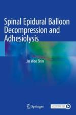 Spinal Epidural Balloon Decompression and Adhesiolysis af Jin Woo Shin