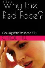 WHY THE RED FACE : DEALING WITH ROSACEA af Chloe Hill