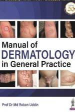 Manual of Dermatology in General Practice af Md Rokon Uddin