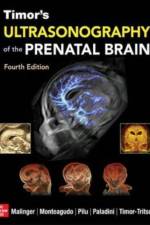 Timor's Ultrasonography of the Prenatal Brain, Fourth Edition af Gustavo Malinger