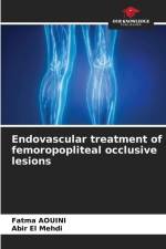 Endovascular treatment of femoropopliteal occlusive lesions af Fatma Aouini