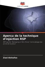 Aperçu de la technique d'injection RSP af Ziad Alshafee