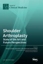 Shoulder Arthroplasty