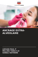 ANCRAGE EXTRA-ALVÉOLAIRE af Leevan Paul P