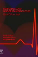 Assessing and Understanding ECGs: The ECG 10+ tool af Karen Ts Konings