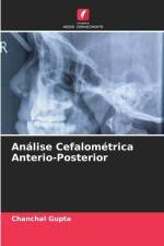 Análise Cefalométrica Anterio-Posterior af Chanchal Gupta