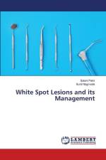 White Spot Lesions and its Management af Saloni Patni