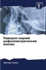 Peredne-zadnij cefalometricheskij analiz af Chanchal Gupta