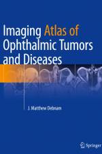 Imaging Atlas of Ophthalmic Tumors and Diseases af J. Matthew Debnam