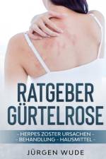 Ratgeber Gürtelrose af Jürgen Wude