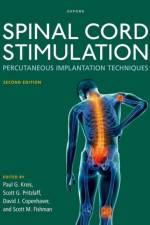 Spinal Cord Stimulation