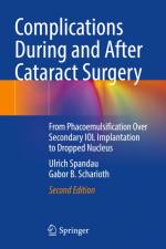 Complications During and After Cataract Surgery af Ulrich Spandau