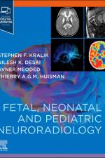 Fetal, Neonatal and Pediatric Neuroradiology af Avner Meoded