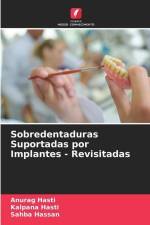 Sobredentaduras Suportadas por Implantes - Revisitadas af Anurag Hasti