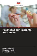 Prothèses sur implants - Réexamen af Anurag Hasti