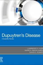 Dupuytren's Disease af Lawrence C. Hurst