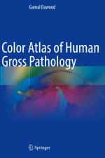 Color Atlas of Human Gross Pathology af Gamal Dawood