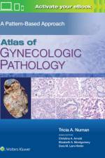 Atlas of Gynecologic Pathology af Tricia A. Numan