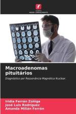 Macroadenomas pituitários af Iridia Ferrán Zúñiga