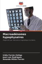 Macroadénomes hypophysaires af Iridia Ferrán Zúñiga