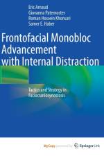 Frontofacial Monobloc Advancement with Internal Distraction af Khonsari Roman Hossein Khonsari