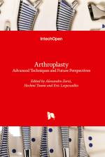 Arthroplasty af Alessandro Rozim Zorzi