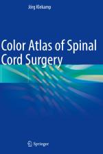 Color Atlas of Spinal Cord Surgery af Jörg Klekamp