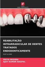 REABILITAÇÃO INTRARRADICULAR DE DENTES TRATADOS ENDODONTICAMENTE af Priya Mishra